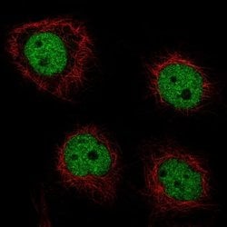 GRHL2 Antibody (CL3760), Novus Biologicals:Antibodies:Primary Antibodies