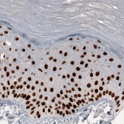 GRHL2 Antibody (CL3760), Novus Biologicals:Antibodies:Primary Antibodies