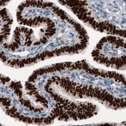 GRHL2 Antibody (CL3760), Novus Biologicals:Antibodies:Primary Antibodies