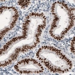 GRHL2 Antibody (CL3760), Novus Biologicals:Antibodies:Primary Antibodies