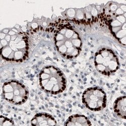 GRHL2 Antibody (CL3760), Novus Biologicals:Antibodies:Primary Antibodies