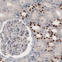 GRHL2 Antibody (CL3760), Novus Biologicals:Antibodies:Primary Antibodies
