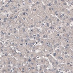GRHL2 Antibody (CL3760), Novus Biologicals:Antibodies:Primary Antibodies