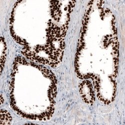 GRHL2 Antibody (CL3760), Novus Biologicals:Antibodies:Primary Antibodies