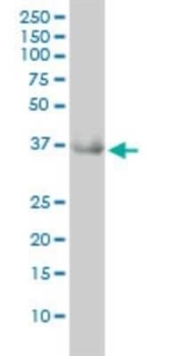 GRHPR Antibody (4E6-1F2), Novus Biologicals 0.1 mg | Buy Online | Novus Biologicals | Fisher Scientific