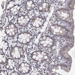 GRHPR Rabbit anti-Human, Polyclonal, Novus Biologicals 100 &mu;g | Buy Online | Novus Biologicals | Fisher Scientific