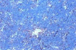 GRK2, p Ser670 Antibody (HL1035), Novus Biologicals 100 &mu;g | Buy Online | Novus Biologicals | Fisher Scientific