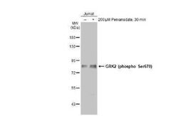GRK2, p Ser670 Antibody (HL1035), Novus Biologicals 100 &mu;g | Buy Online | Novus Biologicals | Fisher Scientific