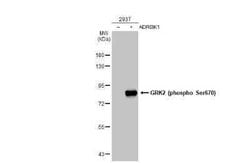 GRK2, p Ser670 Antibody (HL1035), Novus Biologicals 100 &mu;g | Buy Online | Novus Biologicals | Fisher Scientific