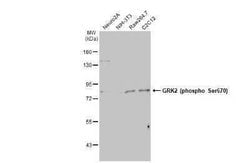 GRK2, p Ser670 Antibody (HL1035), Novus Biologicals 100 &mu;g | Buy Online | Novus Biologicals | Fisher Scientific