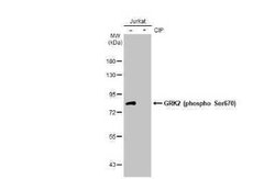 GRK2, p Ser670 Antibody (HL1035), Novus Biologicals 100 &mu;g | Buy Online | Novus Biologicals | Fisher Scientific