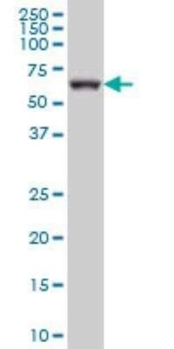 GRK6 Antibody (8D9), Novus Biologicals 0.1 mg | Buy Online | Novus Biologicals | Fisher Scientific