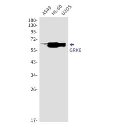 GRK6 Antibody (S07-3E4), Novus Biologicals 100 &mu;g; Unconjugated:Antibodies,