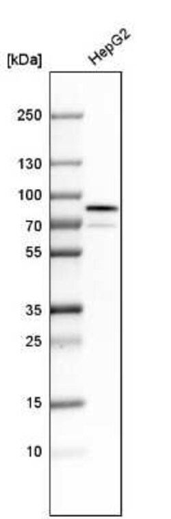 GRP78/HSPA5 Antibody, Novus Biologicals 25ul; Unconjugated:Antibodies,