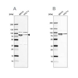 GRP78/HSPA5 Antibody, Novus Biologicals 25ul; Unconjugated:Antibodies,
