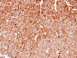 gp96/HSP90B1/GRP94 Antibody, Novus Biologicals gp96/HSP90B1/GRP94 Antibody;