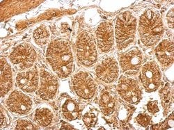 gp96/HSP90B1/GRP94 Antibody, Novus Biologicals gp96/HSP90B1/GRP94 Antibody;