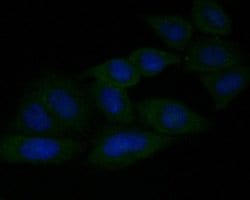 GSDMDC1 Antibody, Novus Biologicals 100 uL; Unconjugated:Antibodies, Polyclonal