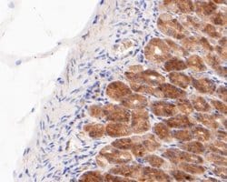 GSDMDC1 Antibody, Novus Biologicals 100 uL; Unconjugated:Antibodies, Polyclonal