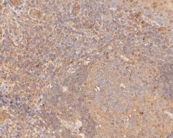 GSDMDC1 Antibody, Novus Biologicals 100 uL; Unconjugated:Antibodies, Polyclonal