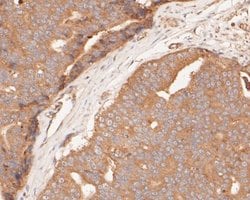 GSDMDC1 Antibody, Novus Biologicals 100 uL; Unconjugated:Antibodies, Polyclonal