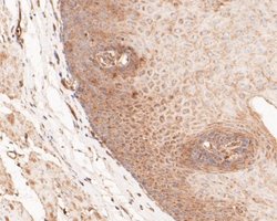 GSDMDC1 Antibody, Novus Biologicals 100 uL; Unconjugated:Antibodies, Polyclonal