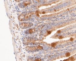 GSDMDC1 Antibody, Novus Biologicals 100 uL; Unconjugated:Antibodies, Polyclonal