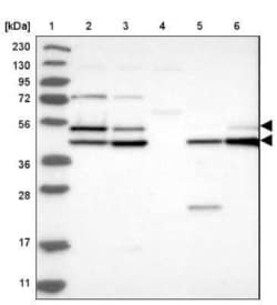 GSK-3 alpha Antibody, Novus Biologicals 0.1 mL; Unconjugated:Antibodies,