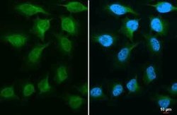 GSK-3 beta Antibody (GT16711), Novus Biologicals 100 &mu;g; Unconjugated:Antibodies,