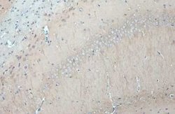 GSK-3 beta Antibody (GT16711), Novus Biologicals 100 &mu;g; Unconjugated:Antibodies,