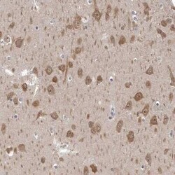 GSK-3 beta Antibody, Novus Biologicals 0.1 mL; Unconjugated:Antibodies,