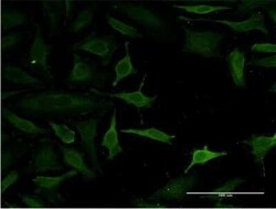 GSKIP Antibody (2F2), Novus Biologicals 0.1 mg | Buy Online | Novus Biologicals | Fisher Scientific