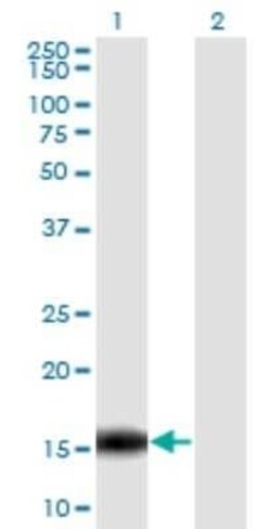 GSKIP Antibody (2F2), Novus Biologicals 0.1 mg | Buy Online | Novus Biologicals | Fisher Scientific