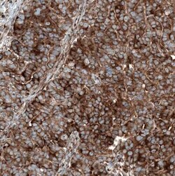 GSPT1 Antibody (CL13332), Novus Biologicals:Antibodies:Primary Antibodies