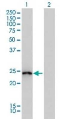 GSTA1 Antibody (2F7), Novus Biologicals 0.1 mg | Buy Online | Novus Biologicals | Fisher Scientific