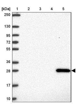 GSTA1 Antibody, Novus Biologicals:Antibodies:Primary Antibodies