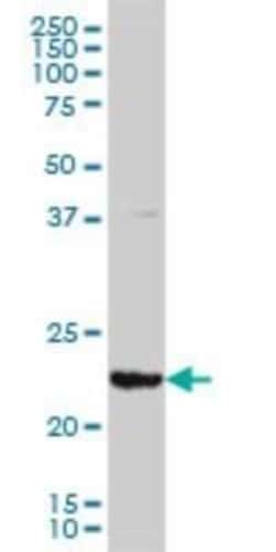 GSTA3 Antibody (1F11), Novus Biologicals 0.1 mg, Unconjugated:Antibodies,