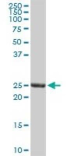 GSTA3 Antibody, Novus Biologicals 0.1 mg | Buy Online | Novus Biologicals | Fisher Scientific