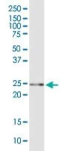 GSTA5 Antibody, Novus Biologicals 0.05 mg; Unconjugated:Antibodies, Polyclonal