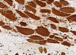 GSTM2 Rabbit anti-Human, Clone: 5, Novus Biologicals 100 &mu;g; Unconjugated:Antibodies,