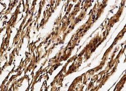 GSTM2 Rabbit anti-Human, Clone: 5, Novus Biologicals 100 &mu;g; Unconjugated:Antibodies,