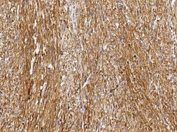 GSTM2 Rabbit anti-Human, Clone: 5, Novus Biologicals 100 &mu;g; Unconjugated:Antibodies,