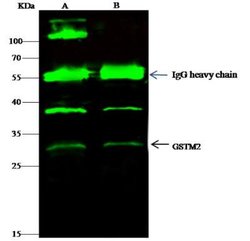 GSTM2 Rabbit anti-Human, Clone: 6, Novus Biologicals 50 &mu;g; Unconjugated:Antibodies,
