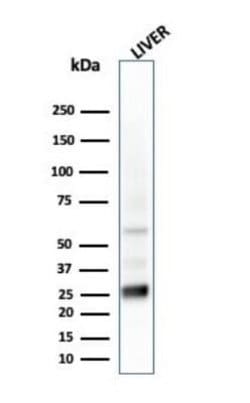 GSTM2 Mouse anti-Human, Clone: CPTC-GSTMu2-2, Novus Biologicals:Antibodies:Primary