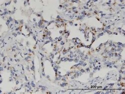 GSTM2 Antibody (1E10), Novus Biologicals 0.1 mg | Buy Online | Novus Biologicals | Fisher Scientific
