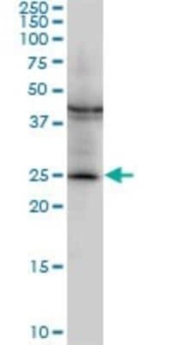 GSTM2 Antibody (1E10), Novus Biologicals 0.1 mg | Buy Online | Novus Biologicals | Fisher Scientific