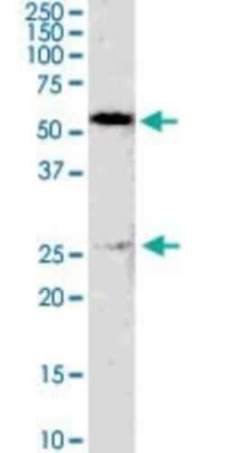 GSTM4 Antibody (4B4), Novus Biologicals 0.1 mg | Buy Online | Novus Biologicals | Fisher Scientific