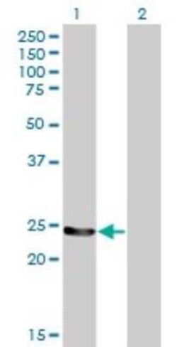 GSTM4 Antibody (4B4), Novus Biologicals 0.1 mg | Buy Online | Novus Biologicals | Fisher Scientific