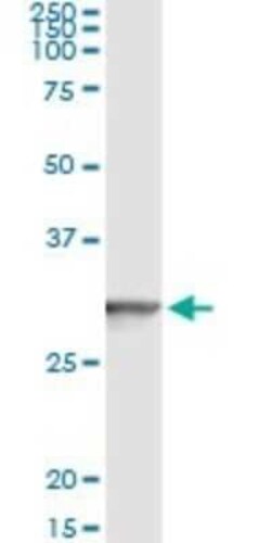 Novus Biologicals GSTT2 Antibody (1C12), Novus Biologicals 0.1 mg | Buy Online | Novus Biologicals&trade; | Fisher Scientific