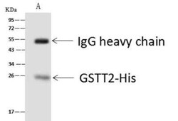 GSTT2B Antibody, Novus Biologicals 50 &mu;g | Buy Online | Novus Biologicals | Fisher Scientific